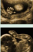 Segon trimestre - El fetus