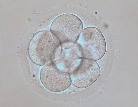 Embrión en estado de 8 células (D+3)