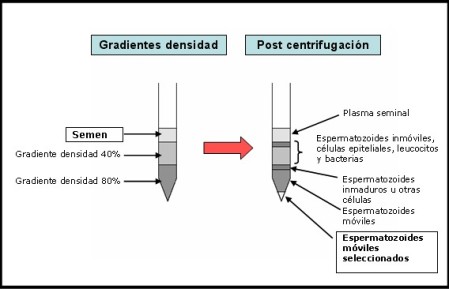 Gradientes densidad - Post centrifugación