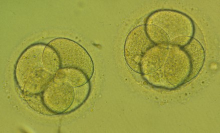 Transferencia en D+2 de dos embriones en estado de 4 células