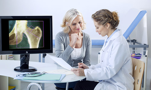 Menopausa - Prevención de la osteoporosis