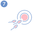 Ovodonació - Fecundació de l’òvul i cultiu dels embrions