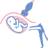 Diagnòstic prenatal - Biopsia corial