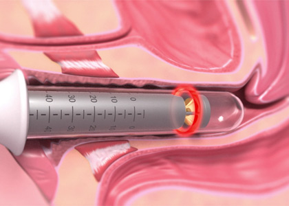 Làser de recuperació funcional - Tractaments